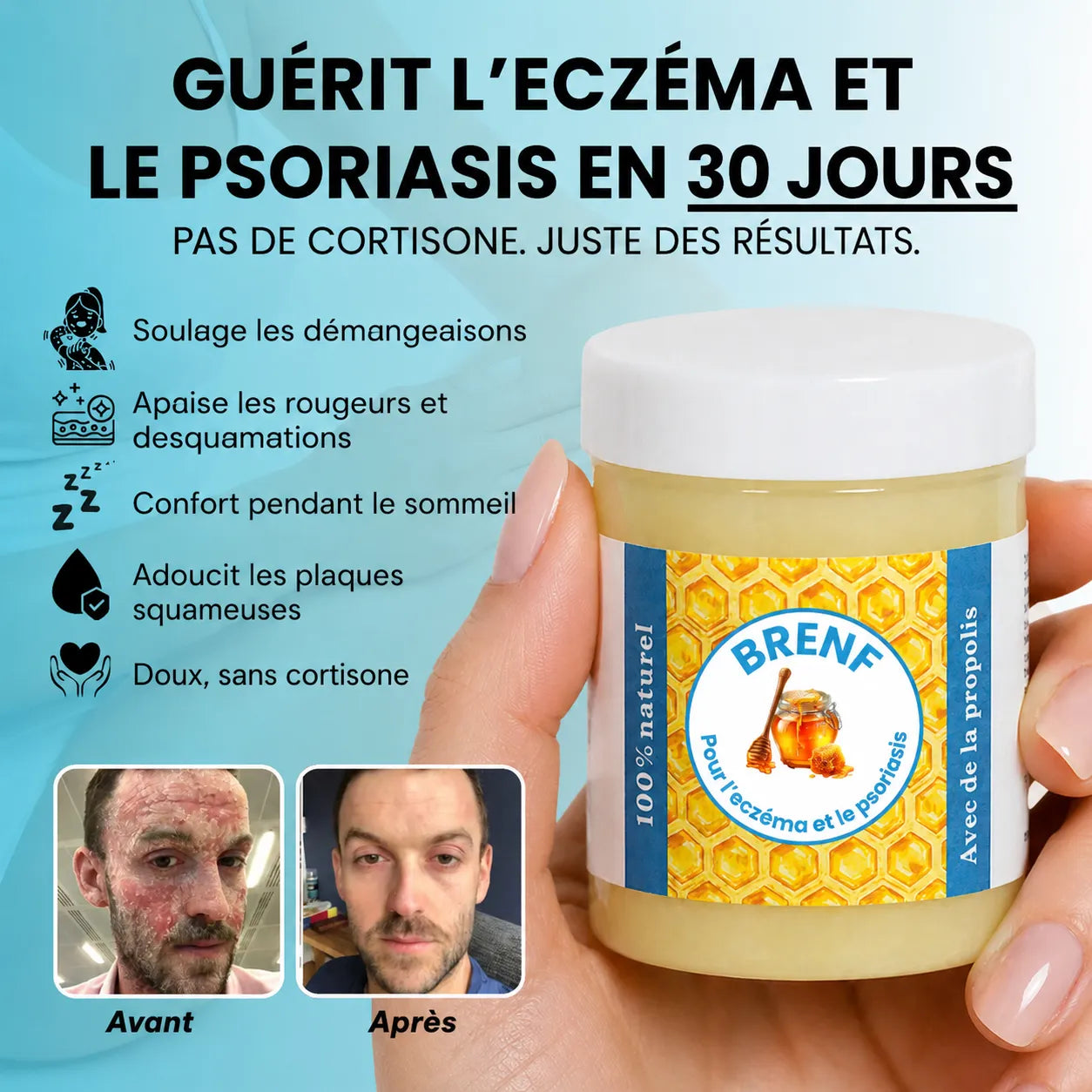 GlacierSkin – Baume Réparateur contre l’Eczéma et le Psoriasis
