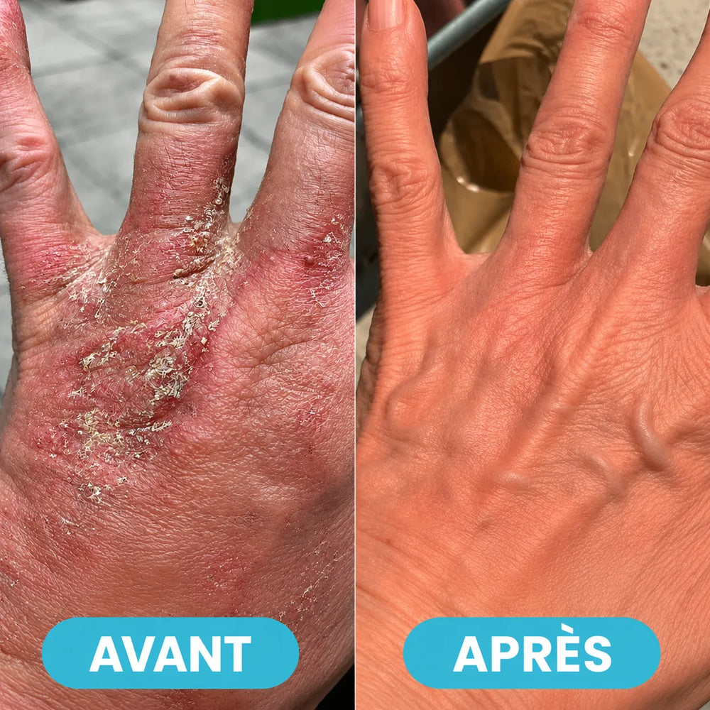 Illustration de la réparation de la barrière cutanée