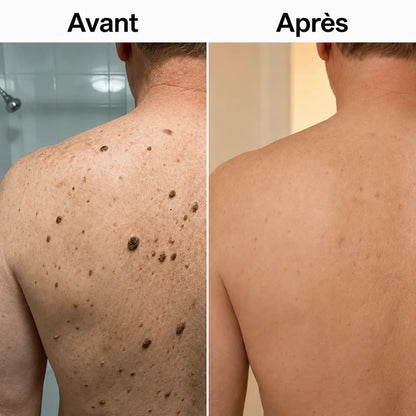 Stick Corps à l’Acide Glycolique BRENF
