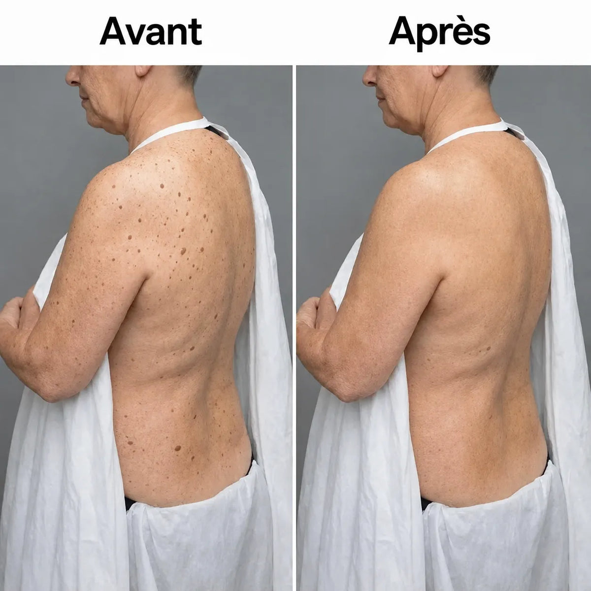 Stick Corps à l’Acide Glycolique BRENF
