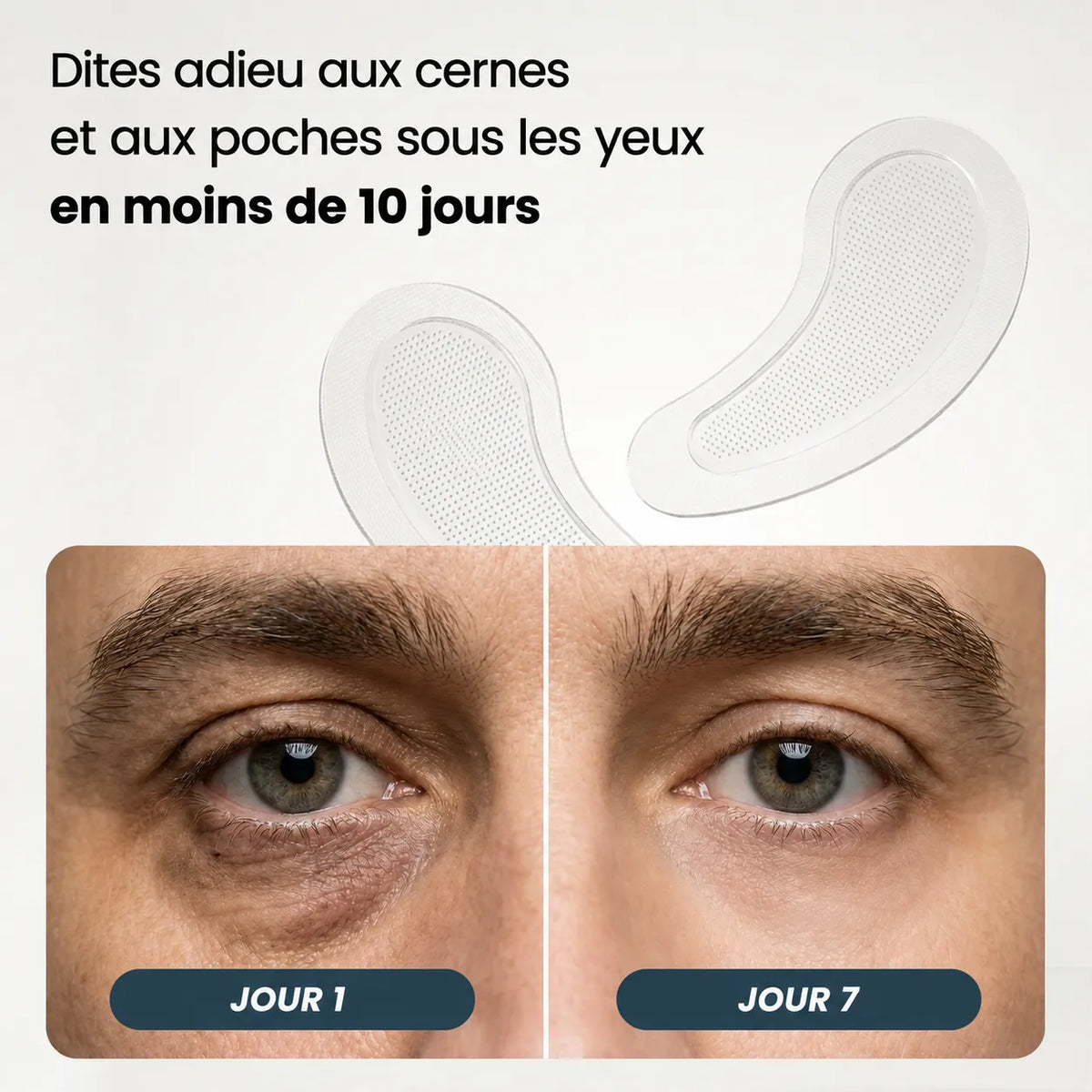 Patchs à micro-aiguilles | Nouvelle génération