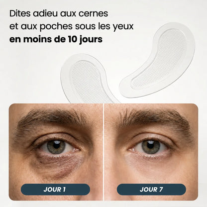 Patchs à micro-aiguilles | Nouvelle génération
